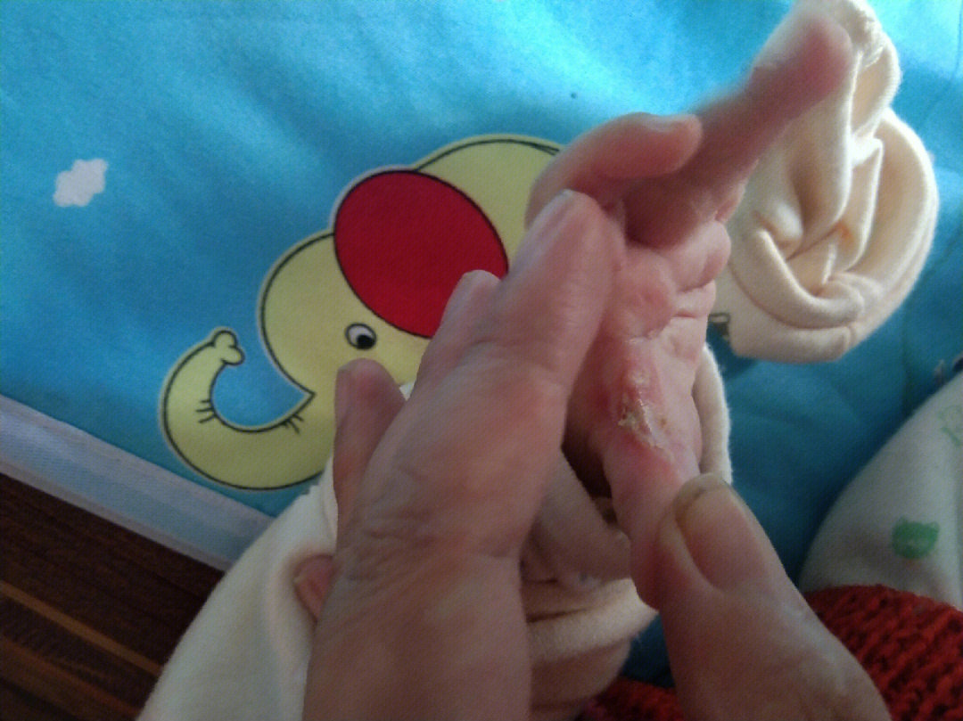 幼儿吃手指细菌图片图片