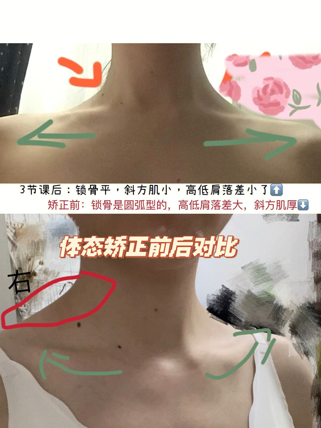 女生斜方肌怎么消除图片