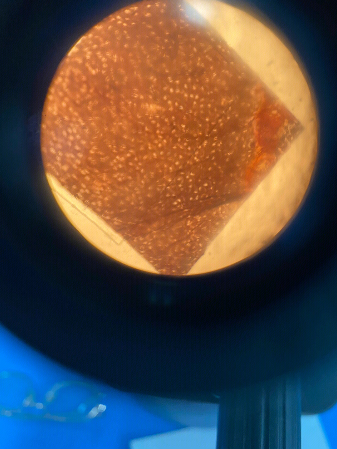 骨磨片显微镜图图片