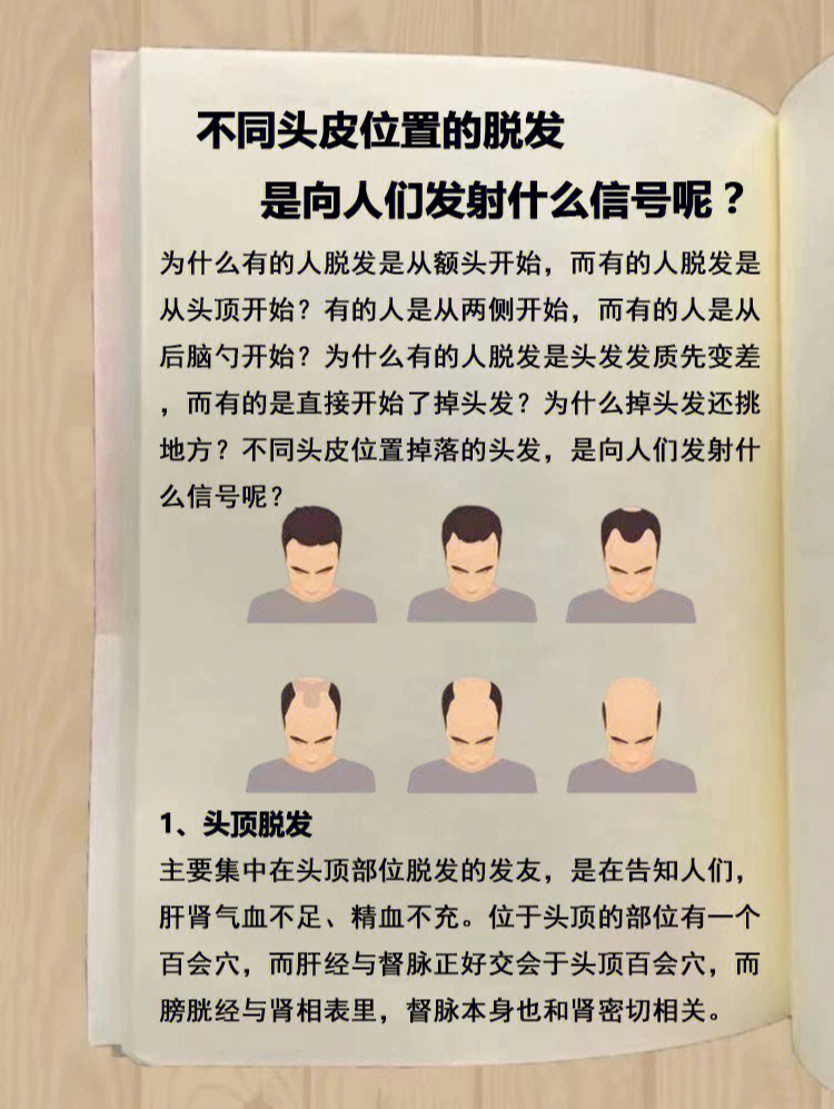 不同头皮位置的脱发75直接因素是哪些71