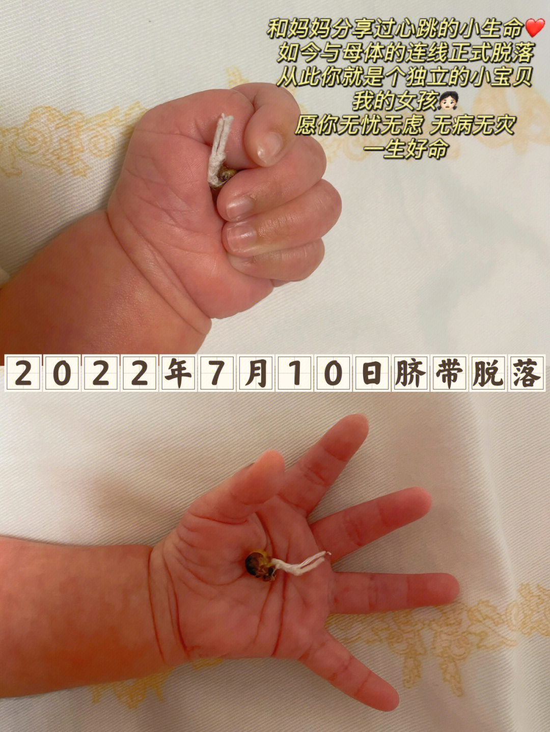 宝宝脐带脱落过程图图片