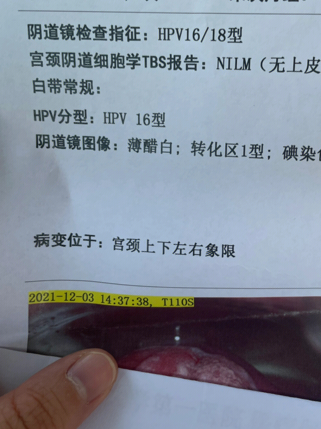 hpv16阳性转阴概率图片