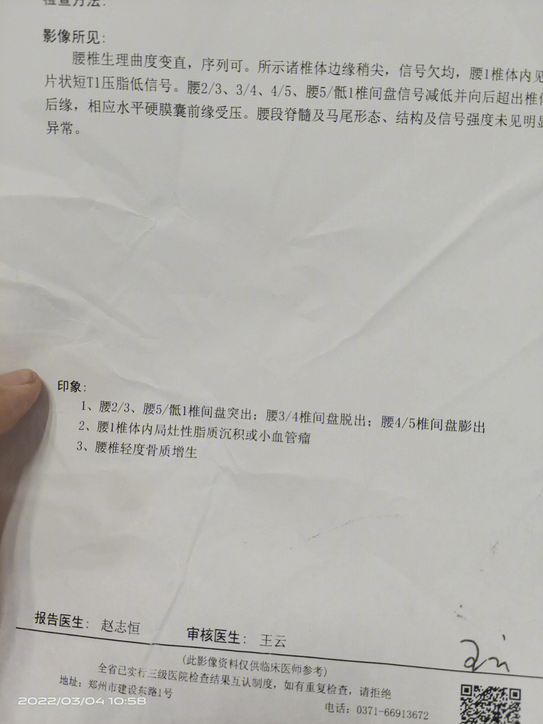 腰椎间盘突出膨出三四脱出