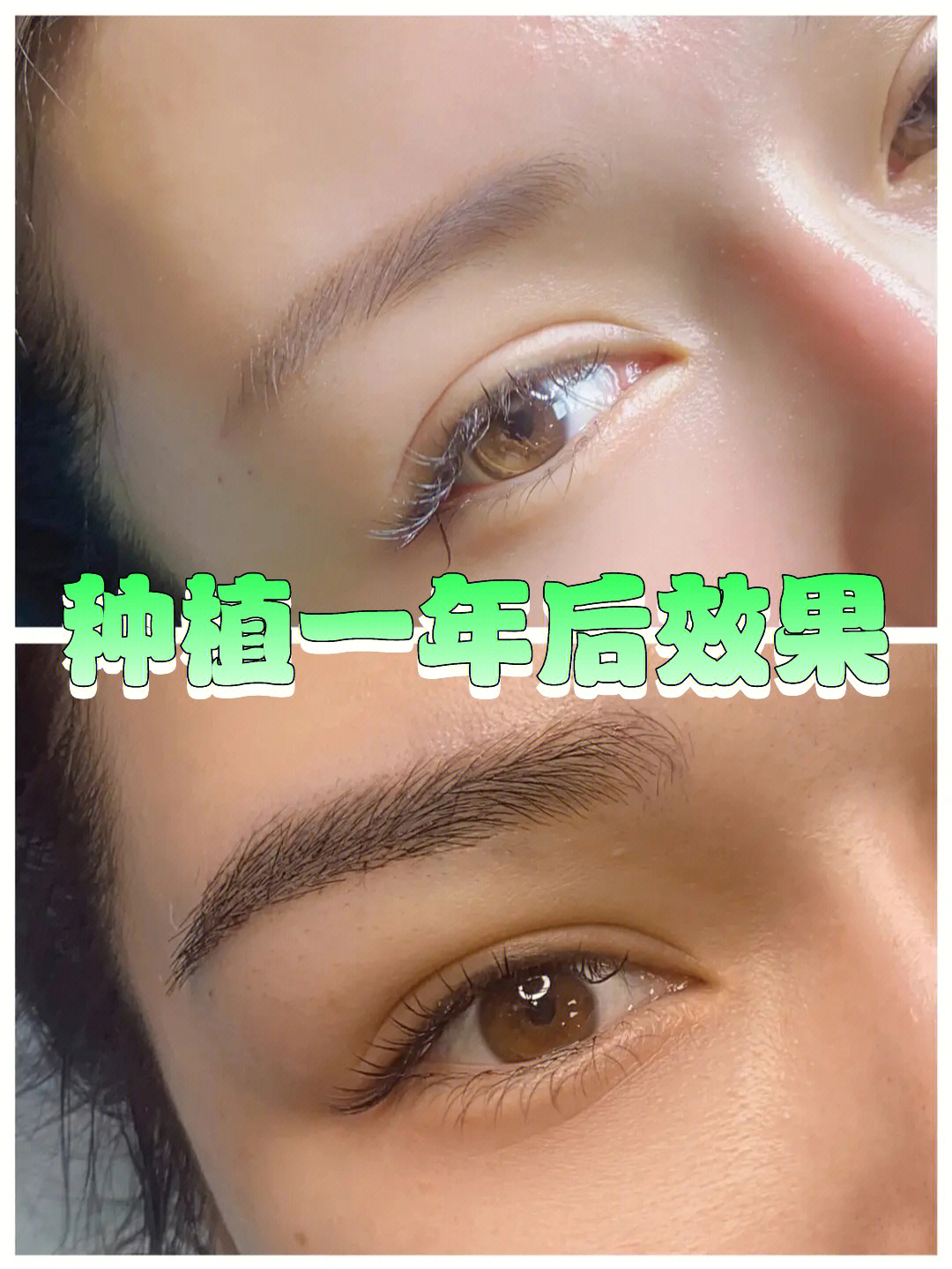 美女植眉一年后效果对比