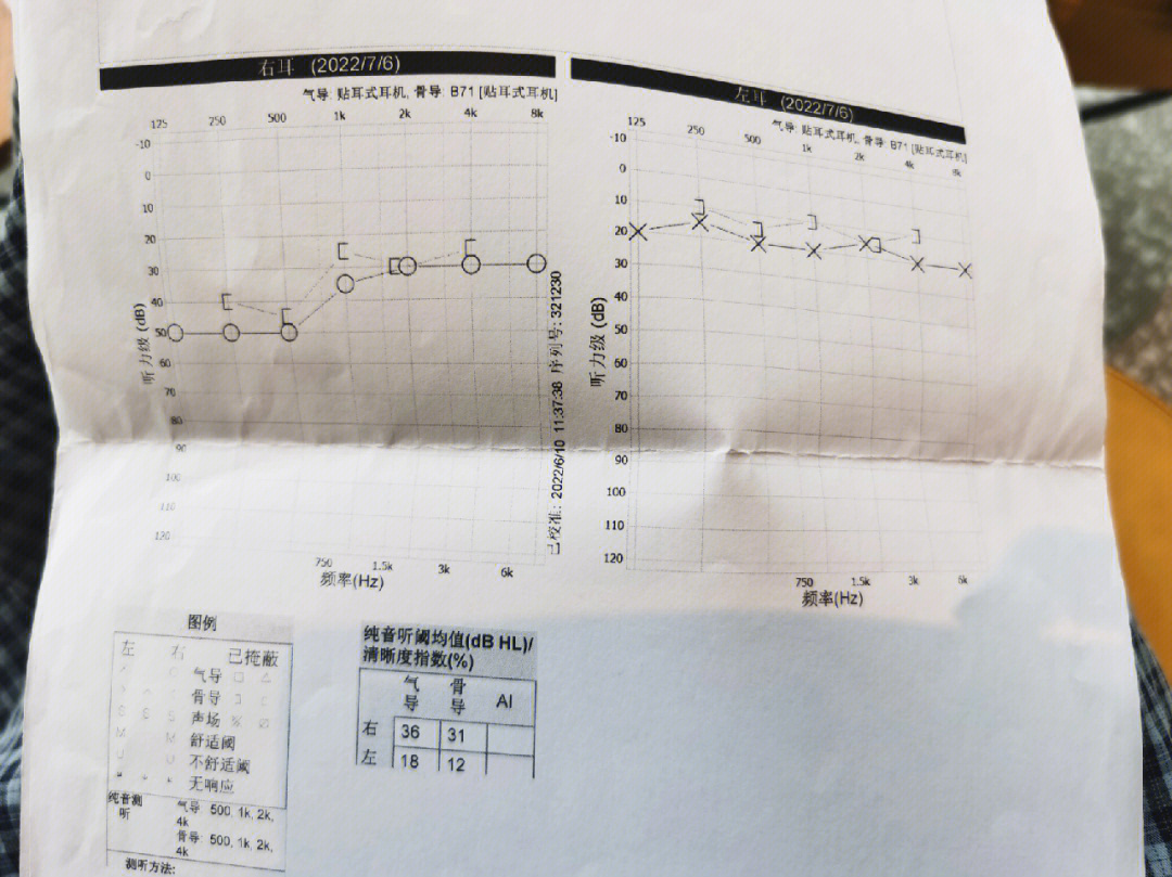 耳石症怎么检查图片