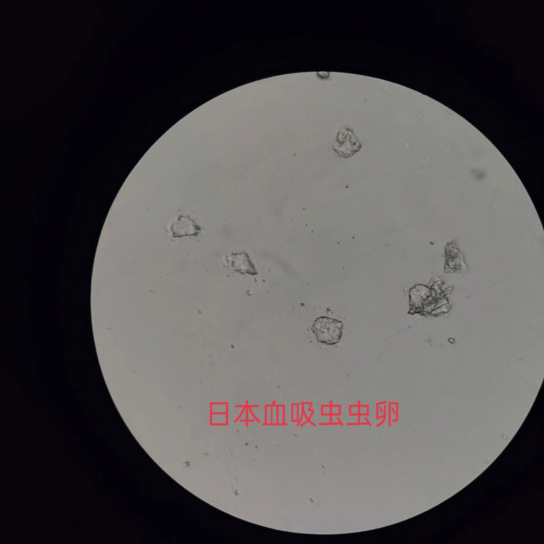 血吸虫卵显微镜图片