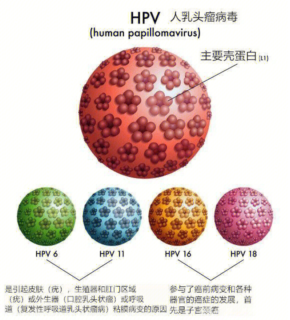 hpv是人乳头瘤病毒的简称,属于疱疹病毒,能引起人体皮肤黏膜的鳞状