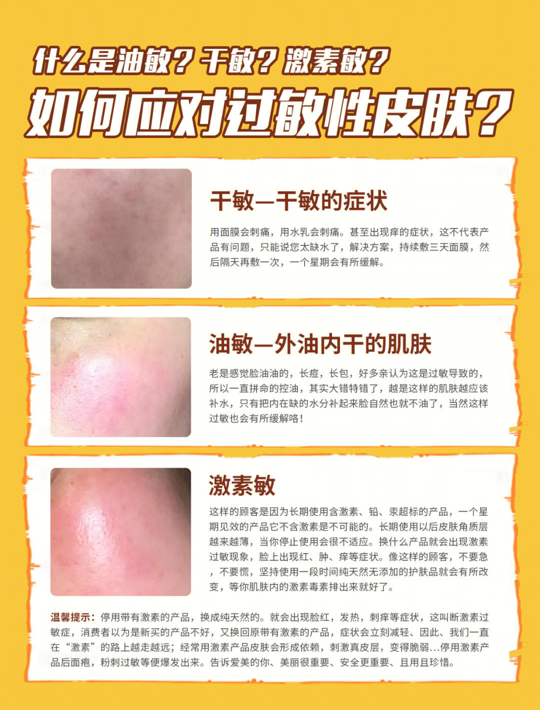 如何应对过敏性皮肤