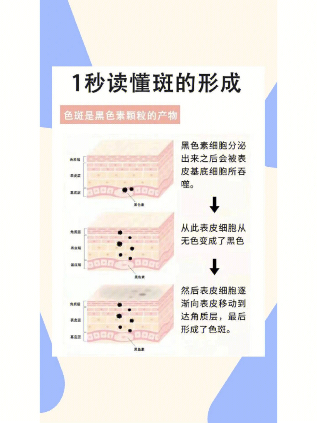 眼角斑是怎么形成的图片