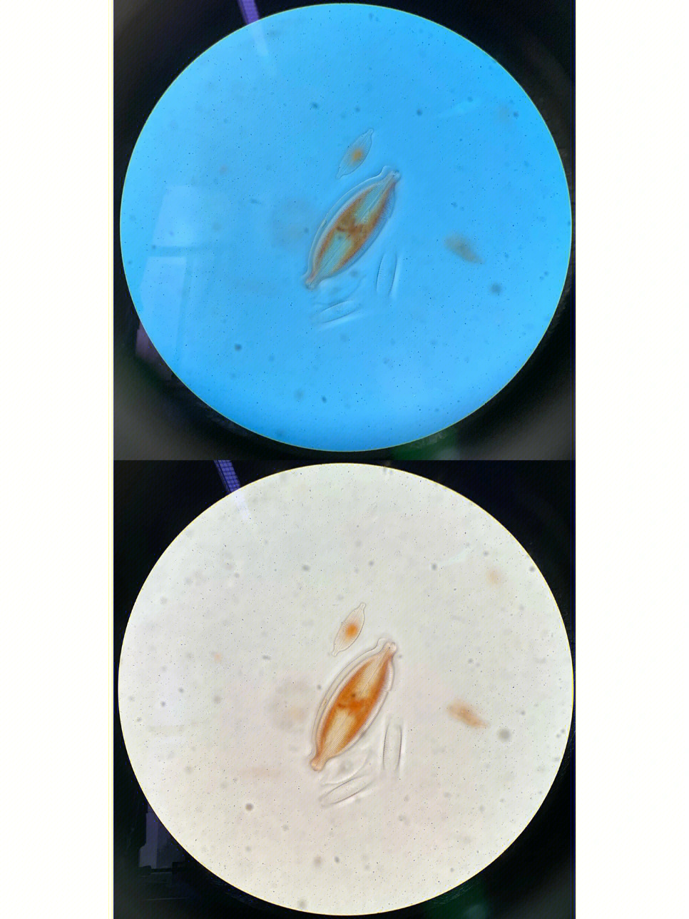 斜生栅藻显微镜图片