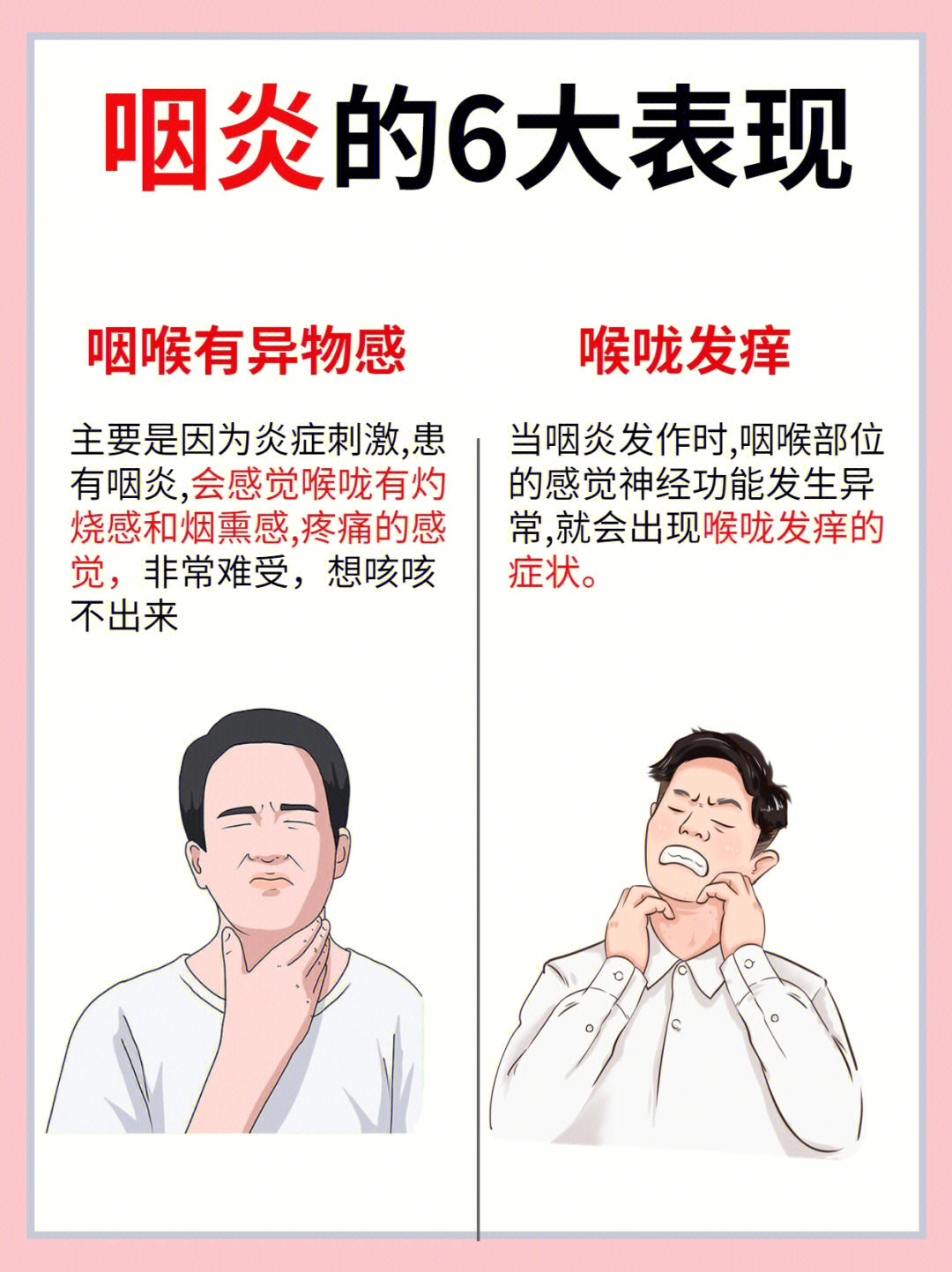 咽炎的主要症状是咽喉疼痛,有异物感,发痒,咳嗽咳痰,喉咙干燥,同时还