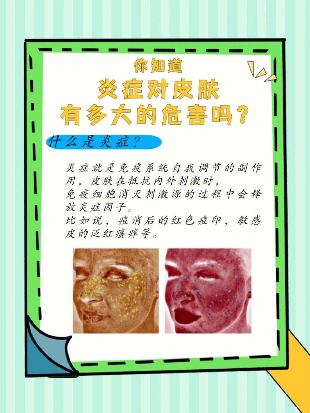 皮肤有炎症怎么办 小红书
