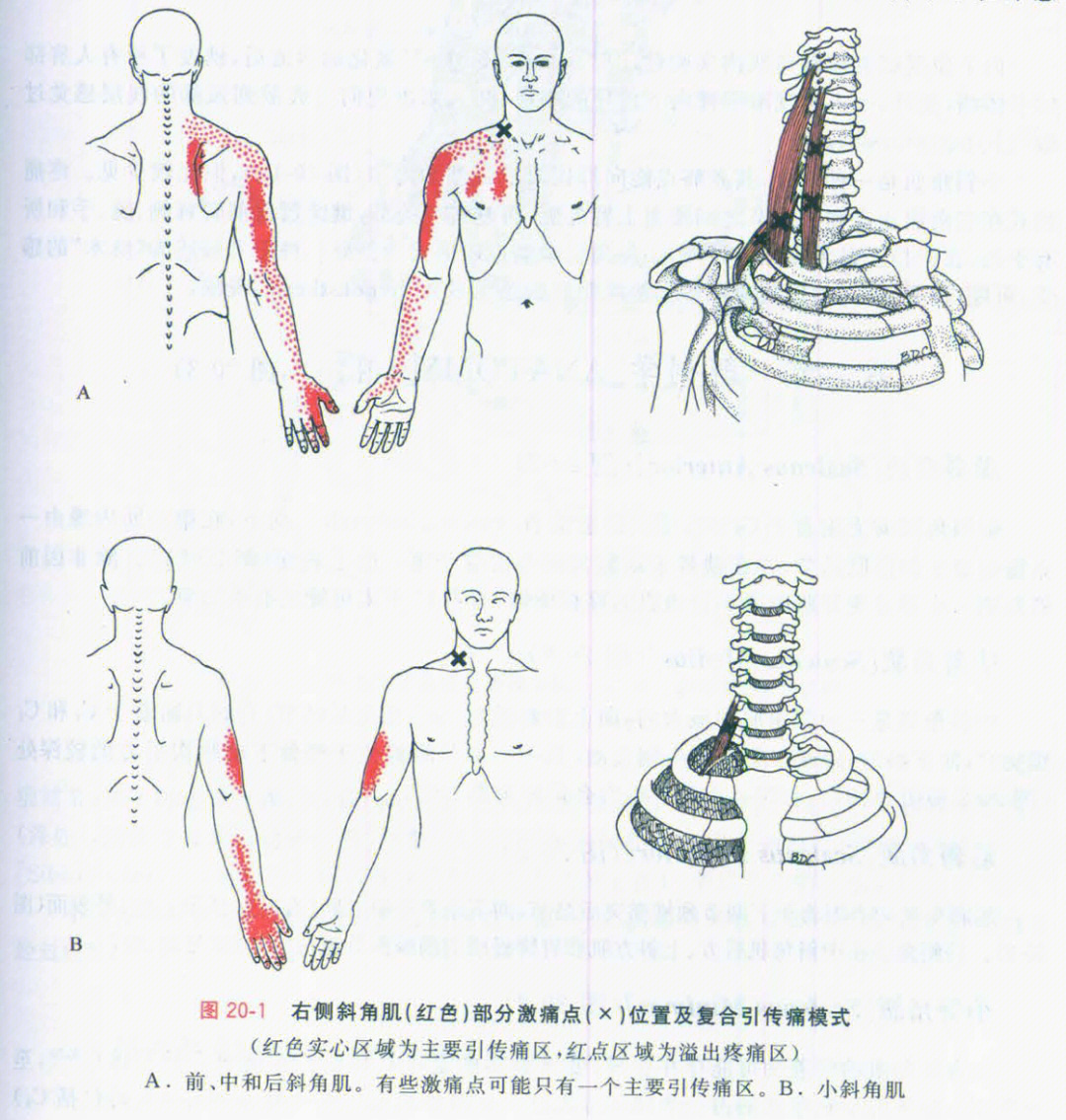 斜角肌后束图片