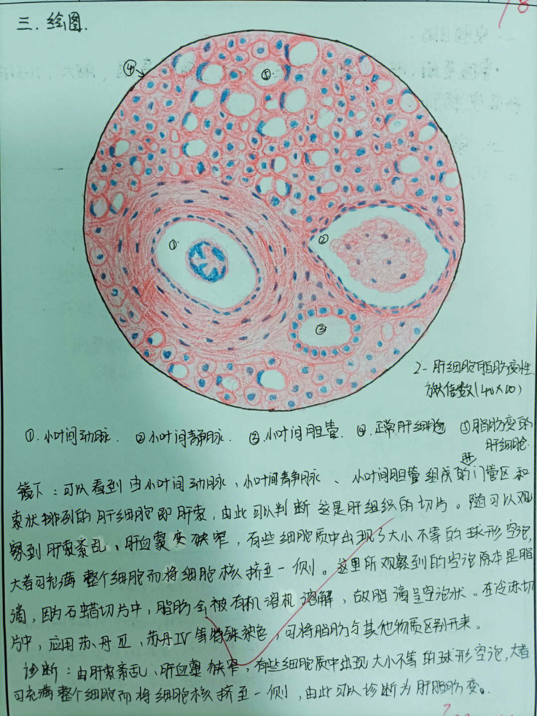 病理学 细胞,组织的适应和损伤 肝脂肪变性 绘图 镜下