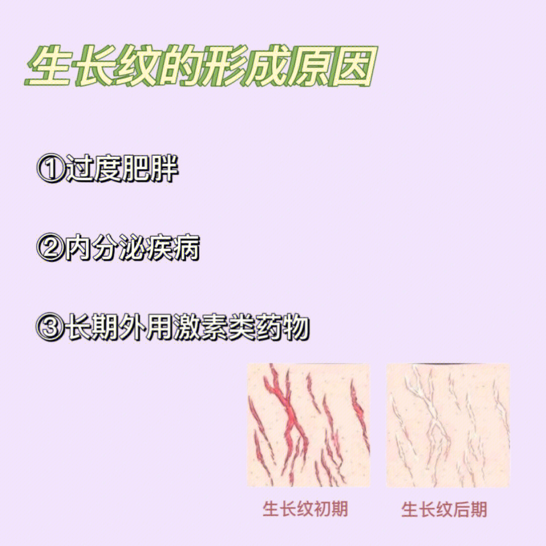 腋下膨胀纹图片