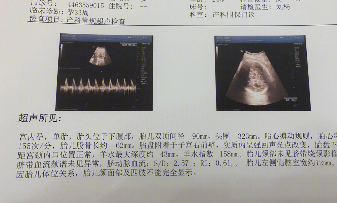 侧脑室增宽图片