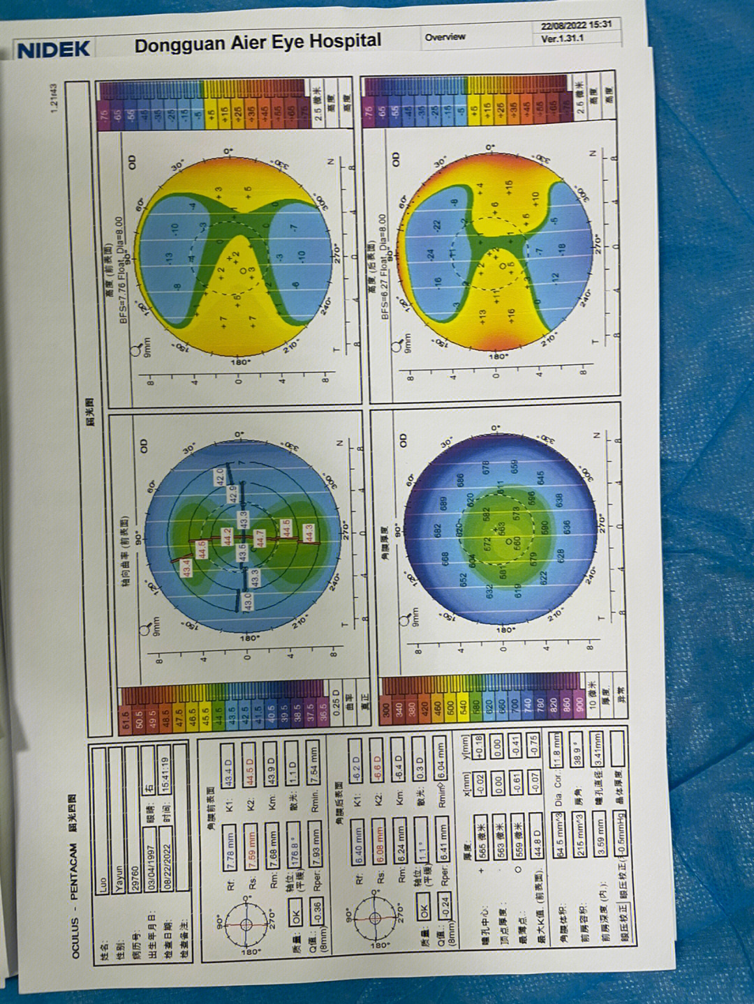 正常瞳孔大小正常值图片