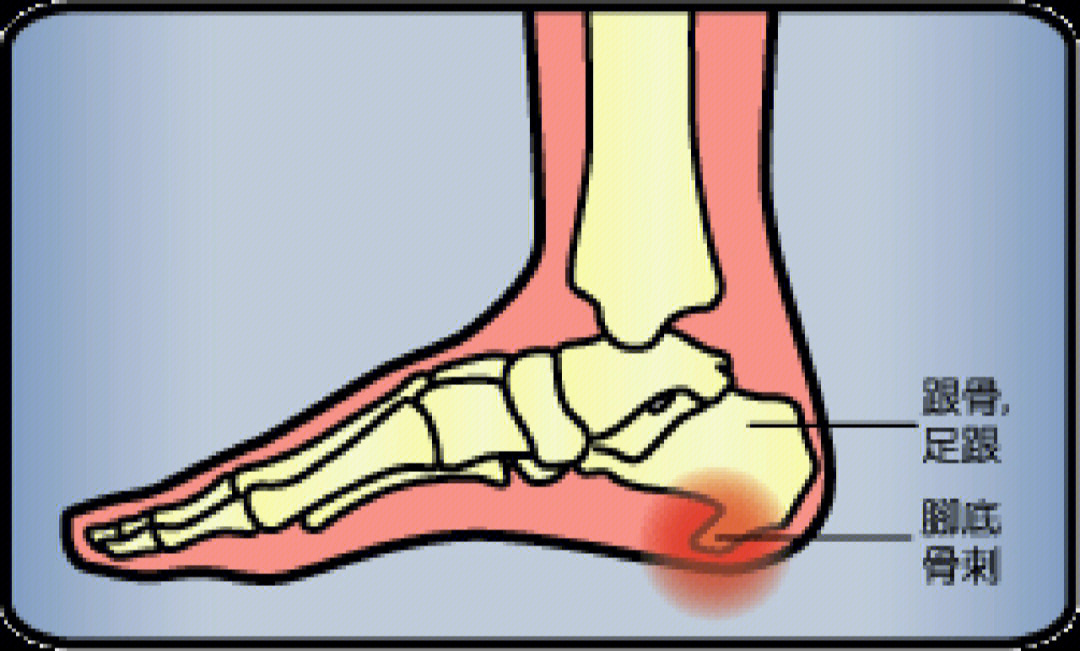 脚根图片