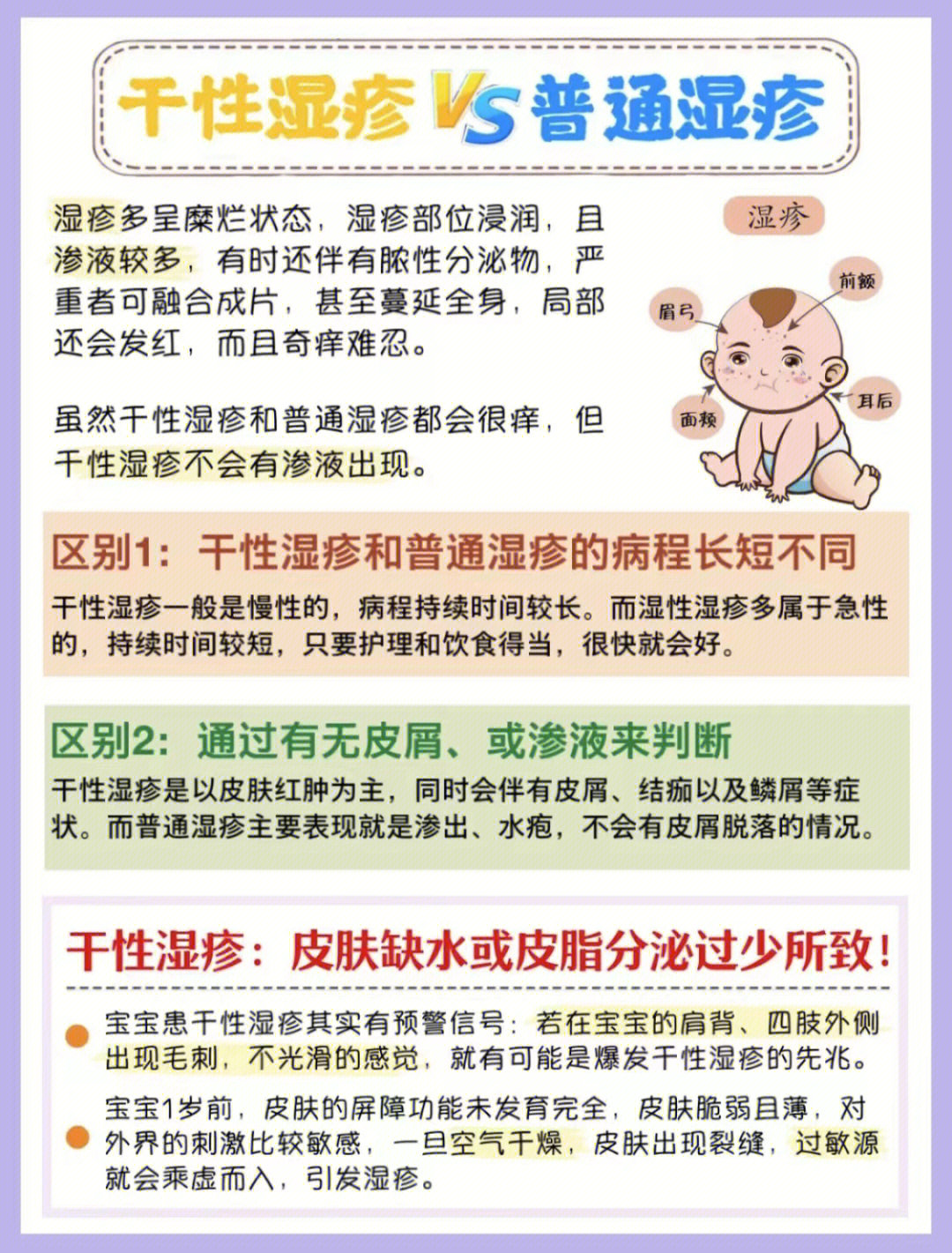 干性湿疹如何治疗图片