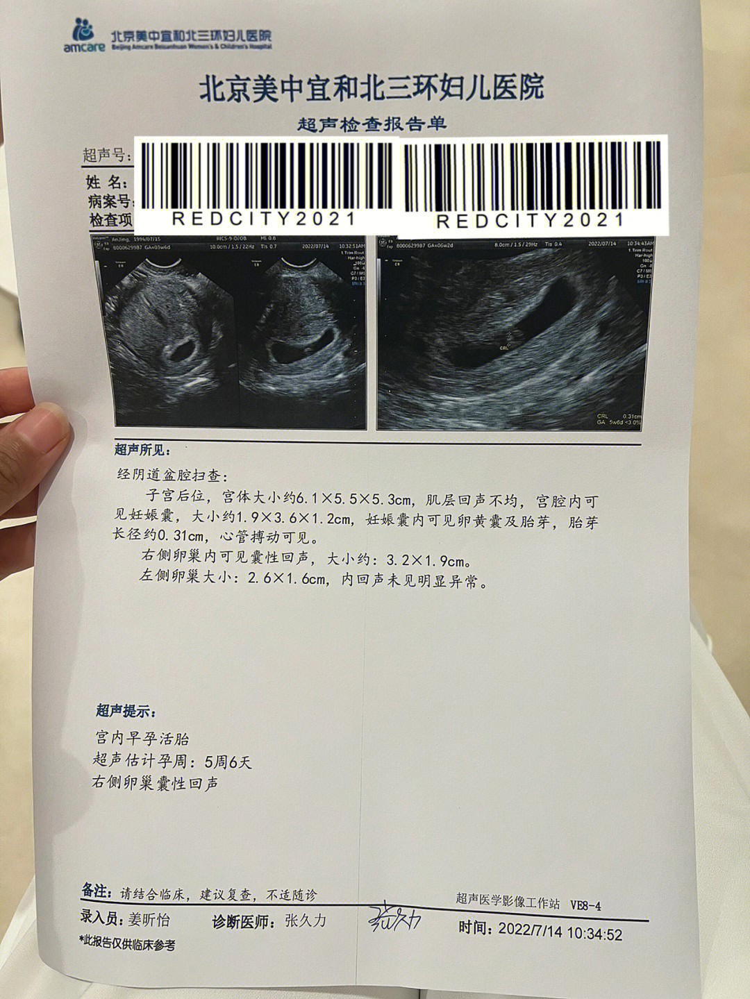 胎心胎芽几周能查出来图片
