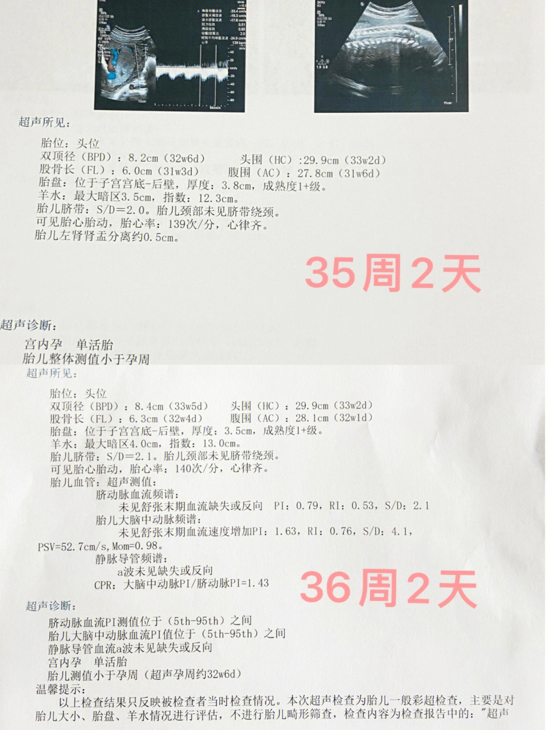 36周胎儿发育标准数据图片