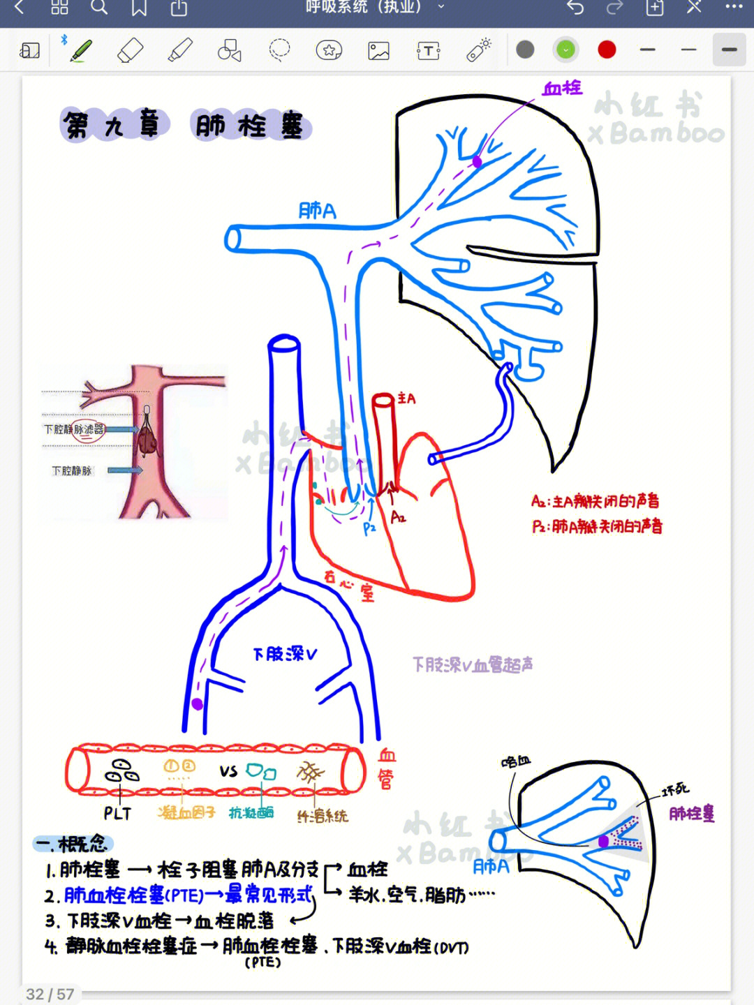 肺栓塞的机制图图片