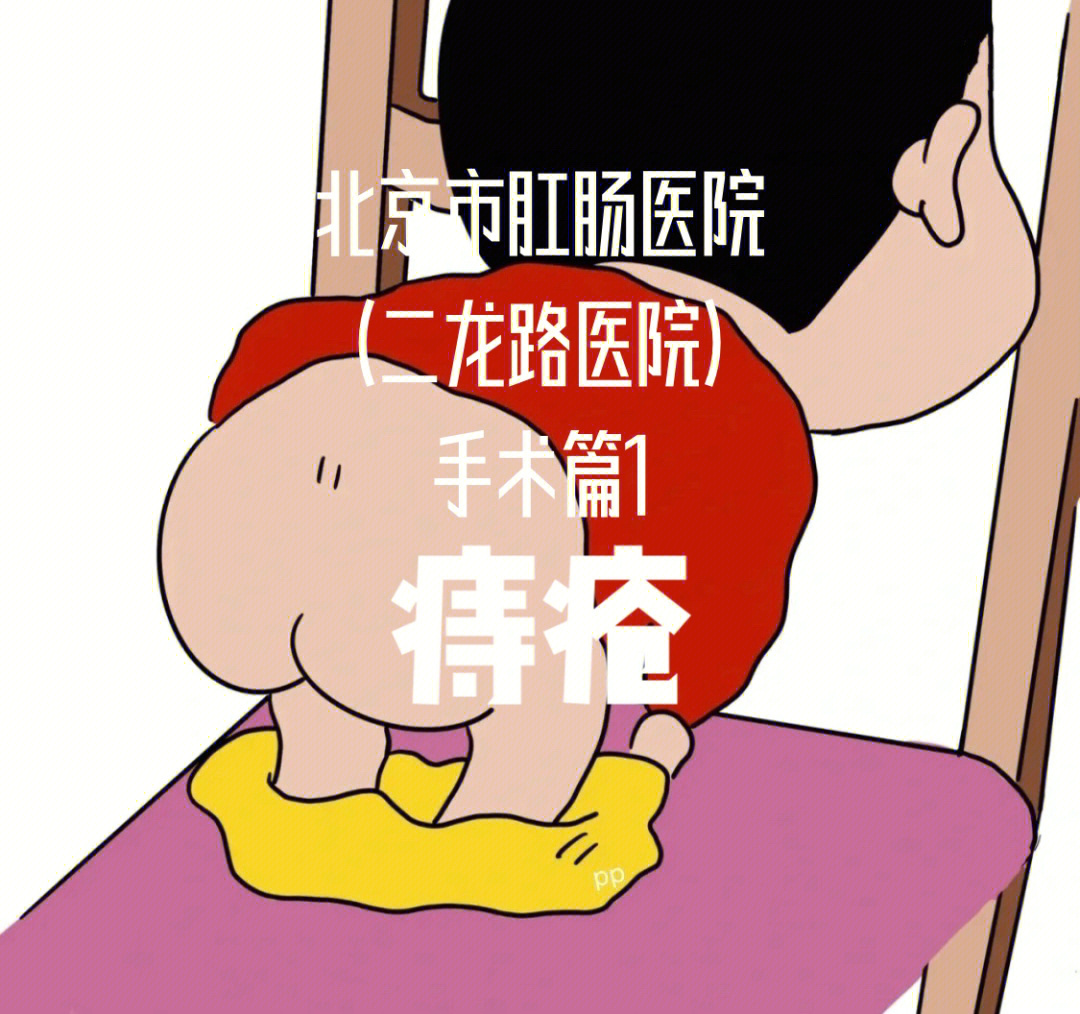 肛裂手术动画图片