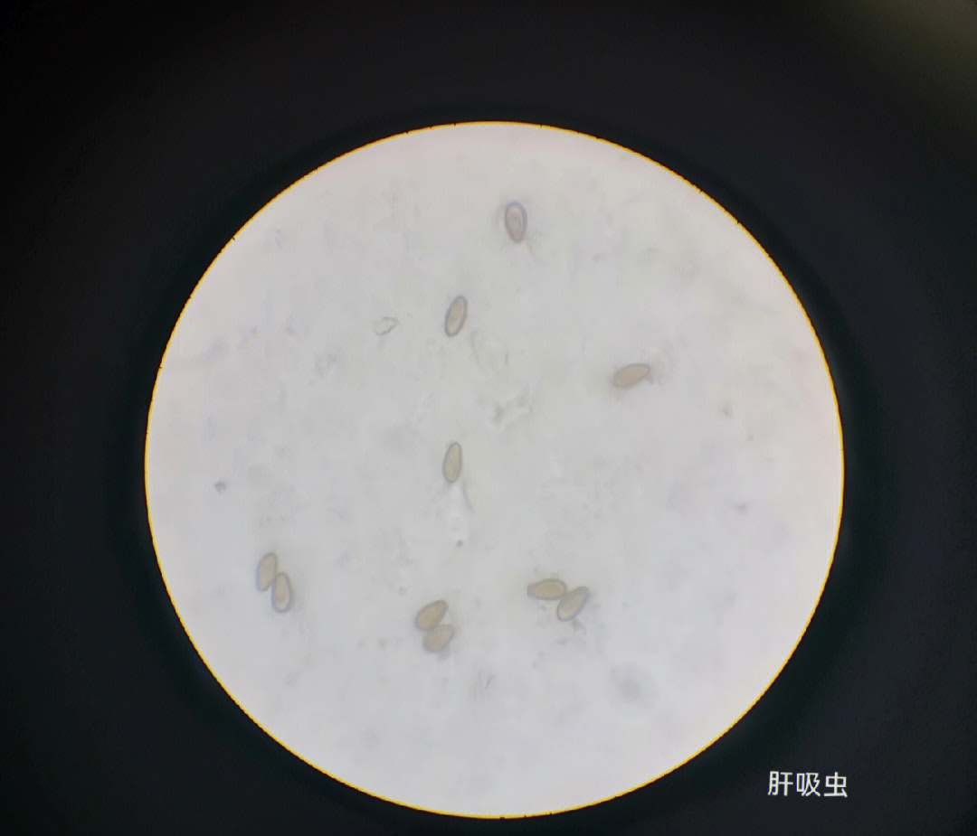 班氏微丝蚴显微镜图片