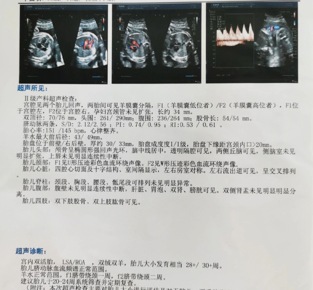 赶在国庆前查了,一个月时间,两个胎儿大小相差两周,一个绕颈一周,一个