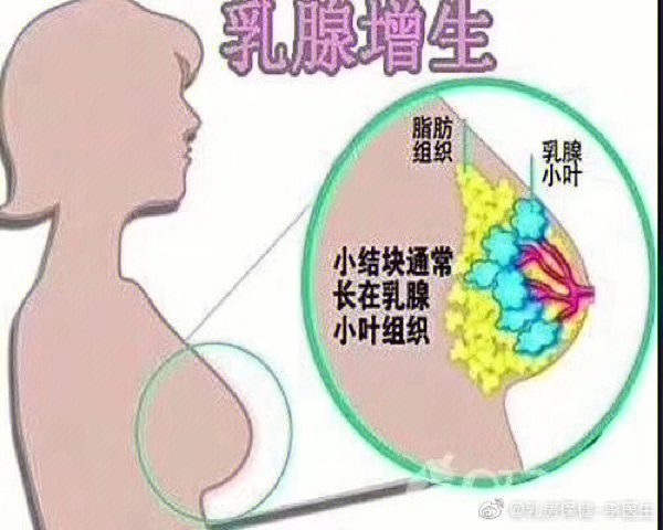 乳腺4个区图 分布图图片