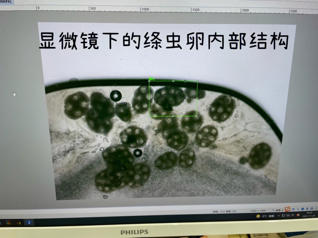 绦虫检查图片