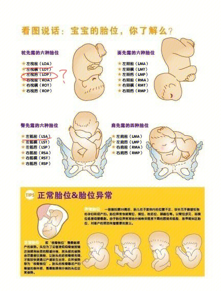 胎儿头位是什么意思图片