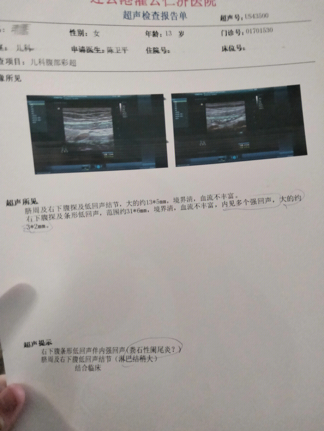 阑尾炎的超声报告模板图片