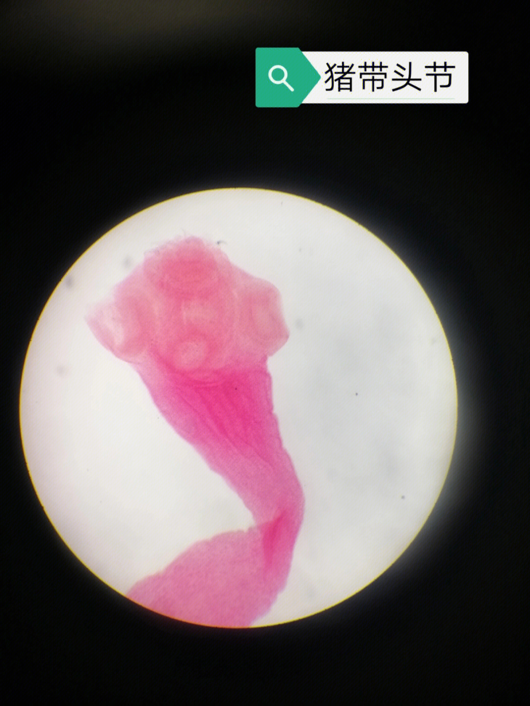 血吸虫成虫显微镜图片图片
