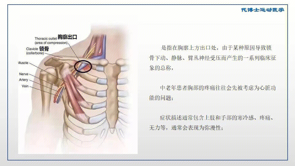 胸阔出口图片