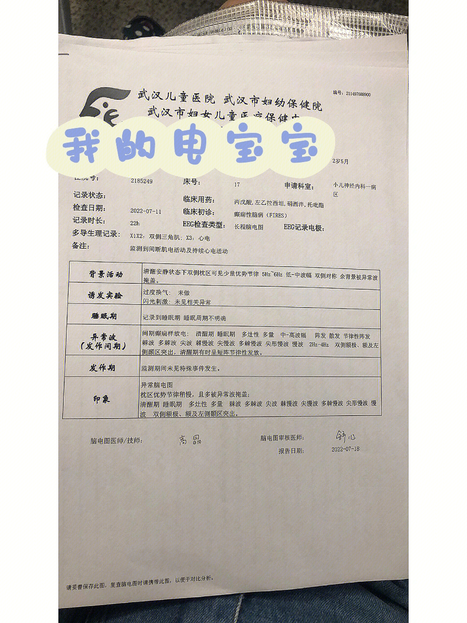 小孩做脑电图注意事项图片