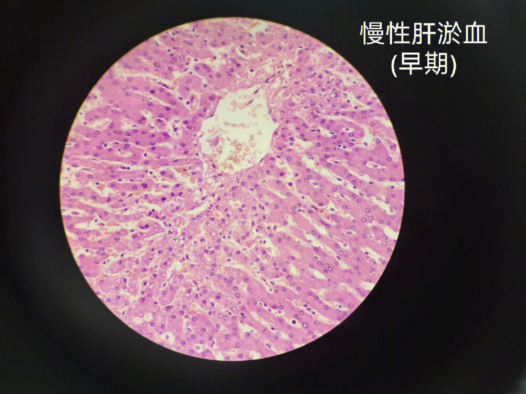 肝组织切片图结构详解图片