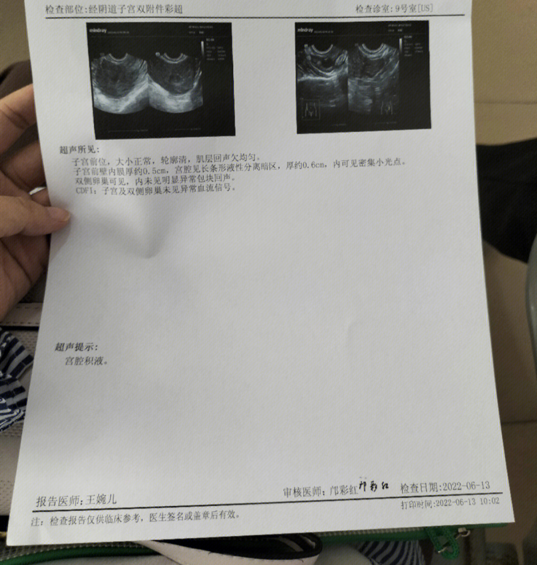 宫腔积血图片图片