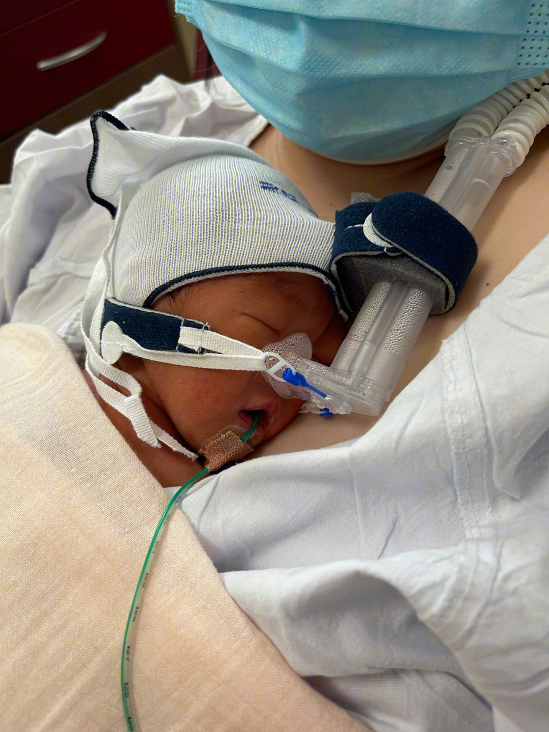 由于早产儿基本上都存在呼吸困难问题,所以得佩戴c