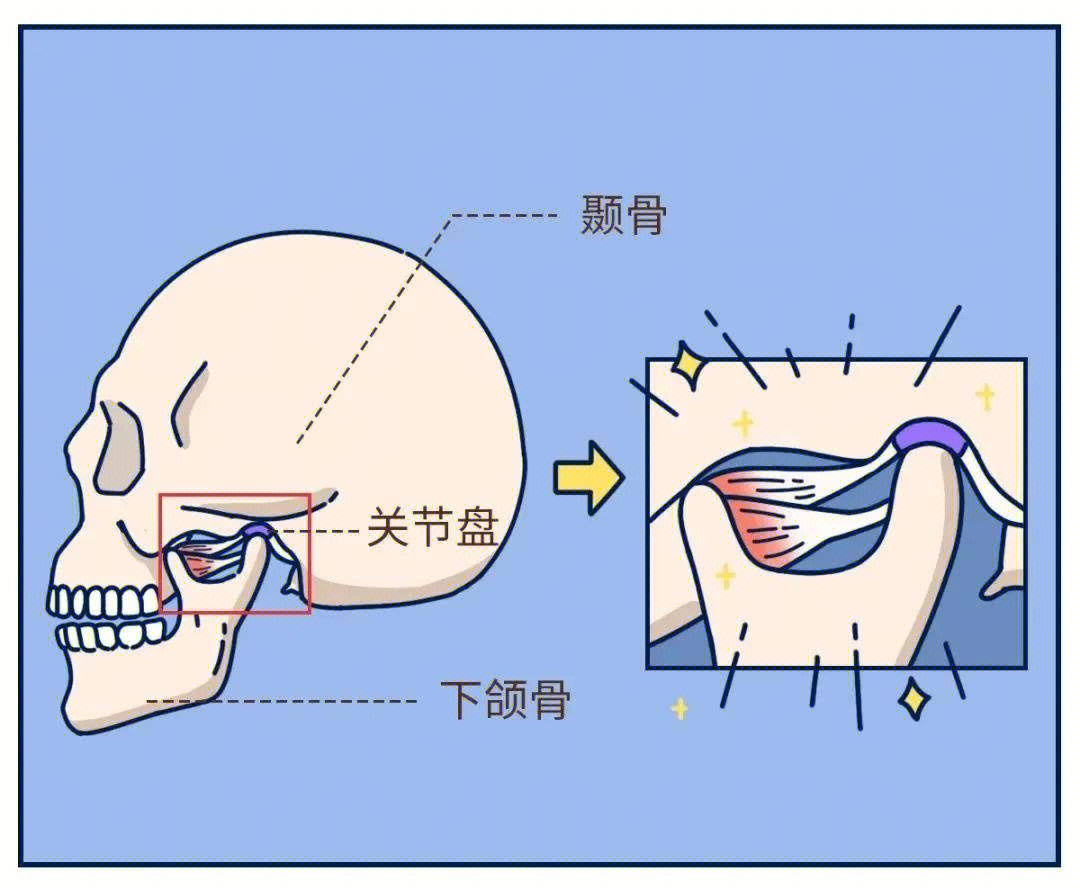 关节结构紊乱疾病,炎性疾病和骨关节病等类型基本病因颞下颌关节是一