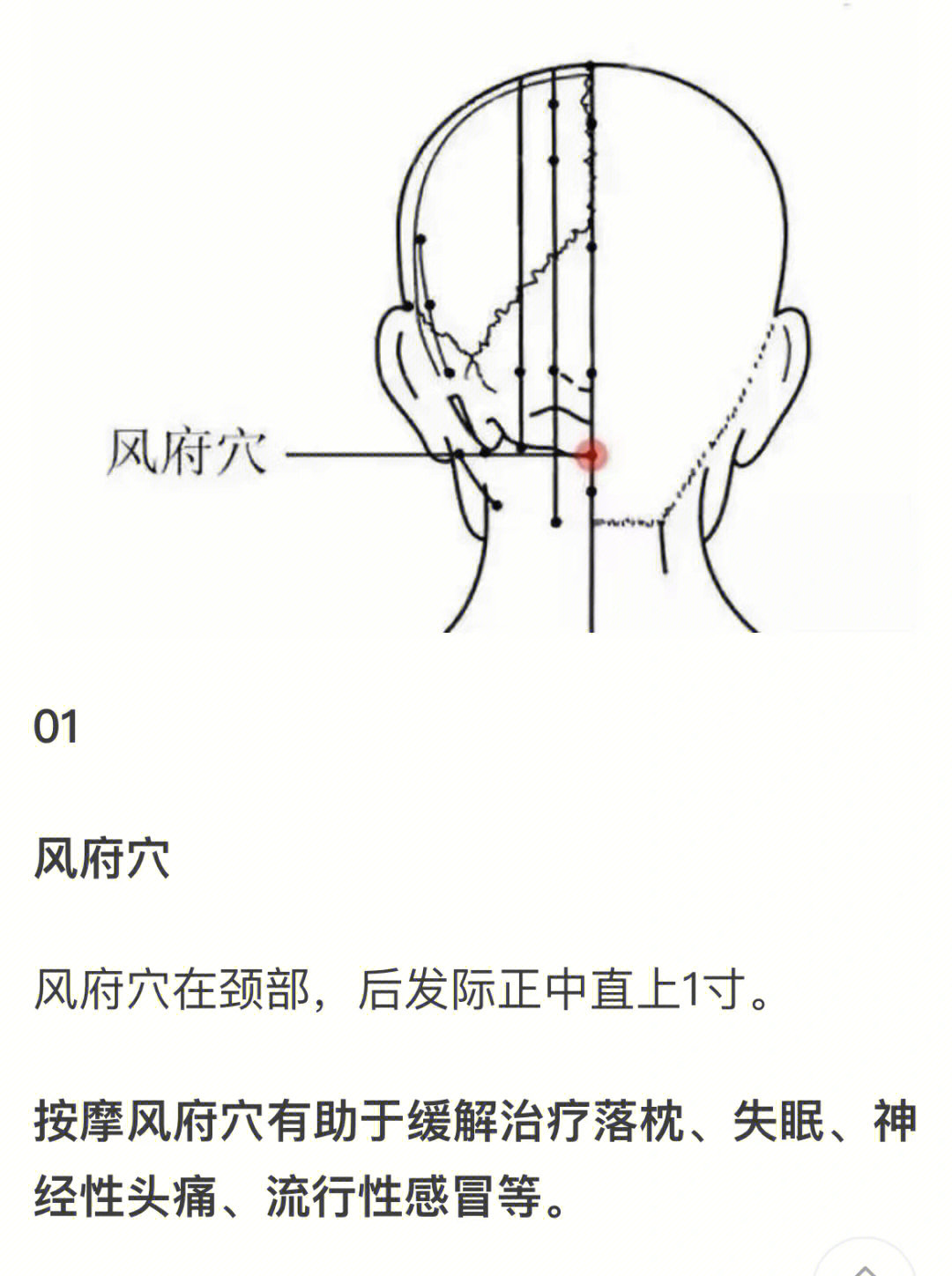 8215风池穴位于颈部,当枕骨之下,与风府穴相平,胸锁乳突肌与