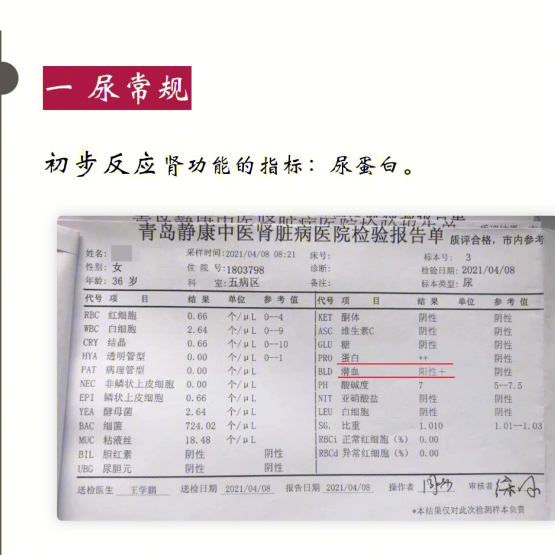 每个指标都有它的优点和缺点,适合不同情况下对患者肾功能情况的判断