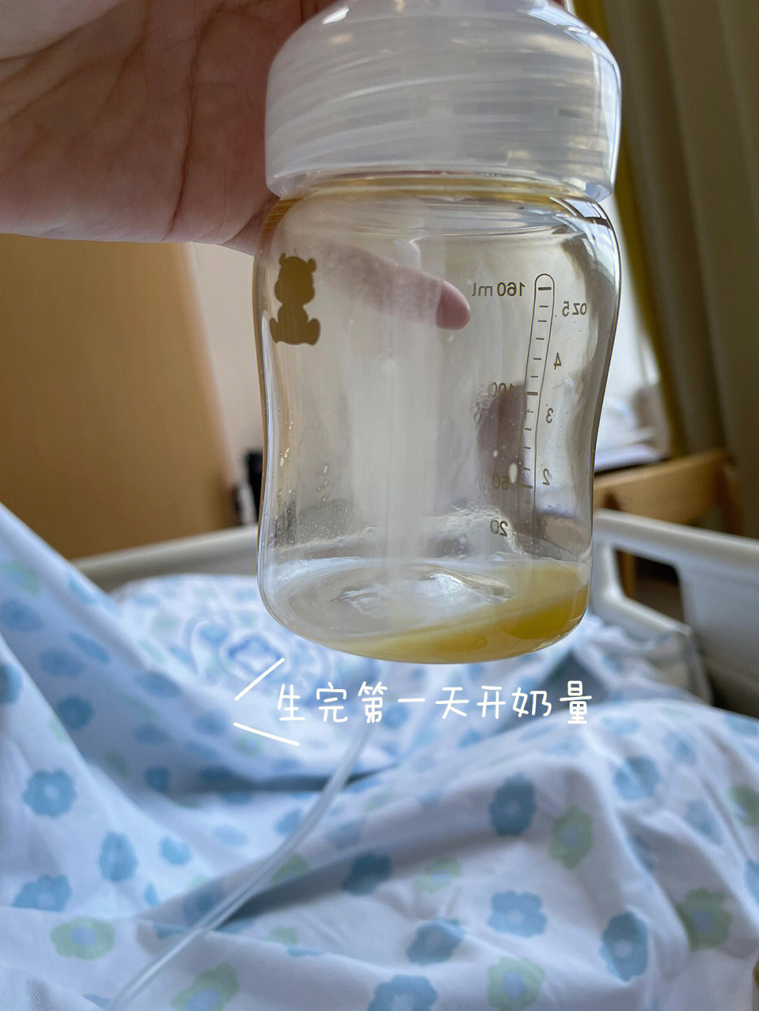 堵奶分享:超大顽固硬块,乳腺炎发烧0202