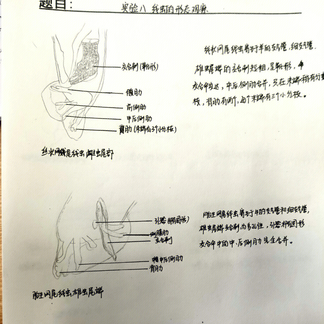 鸡胸肉线虫图片