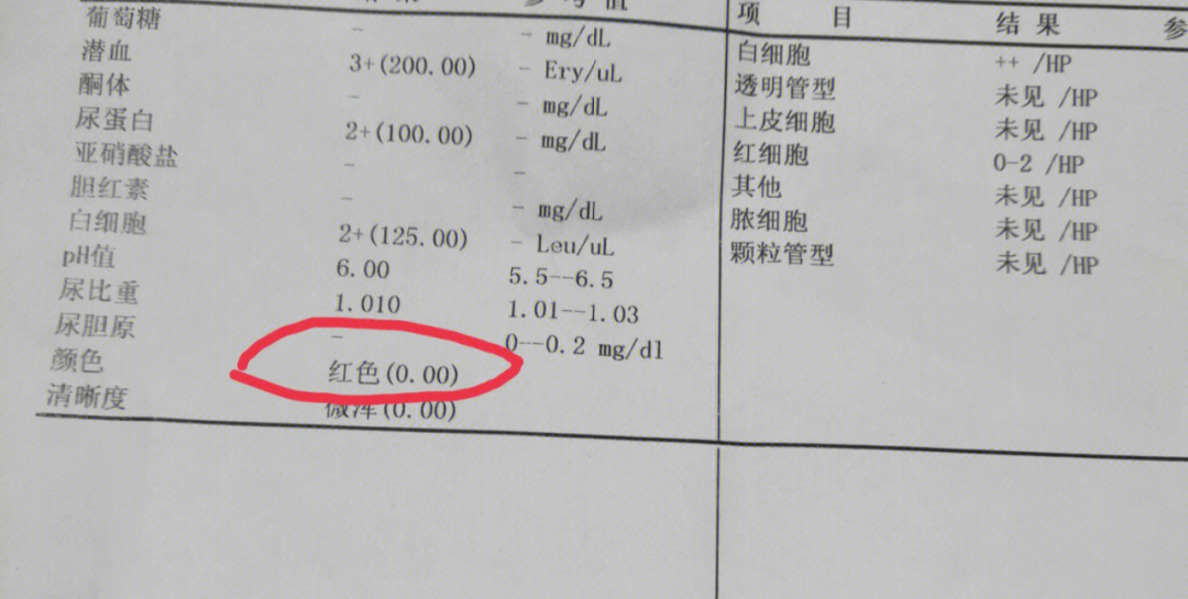 尿液发红怎么回事图片