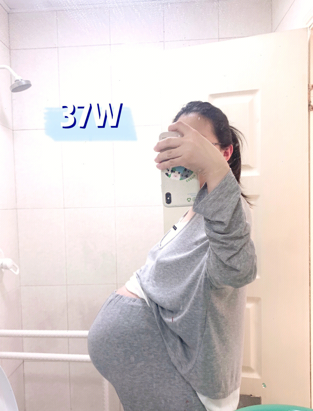 王默怀孕大肚子羊水图片
