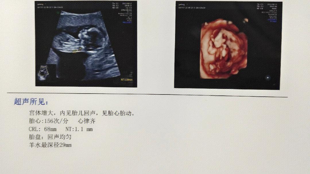 头臀径68mm图片