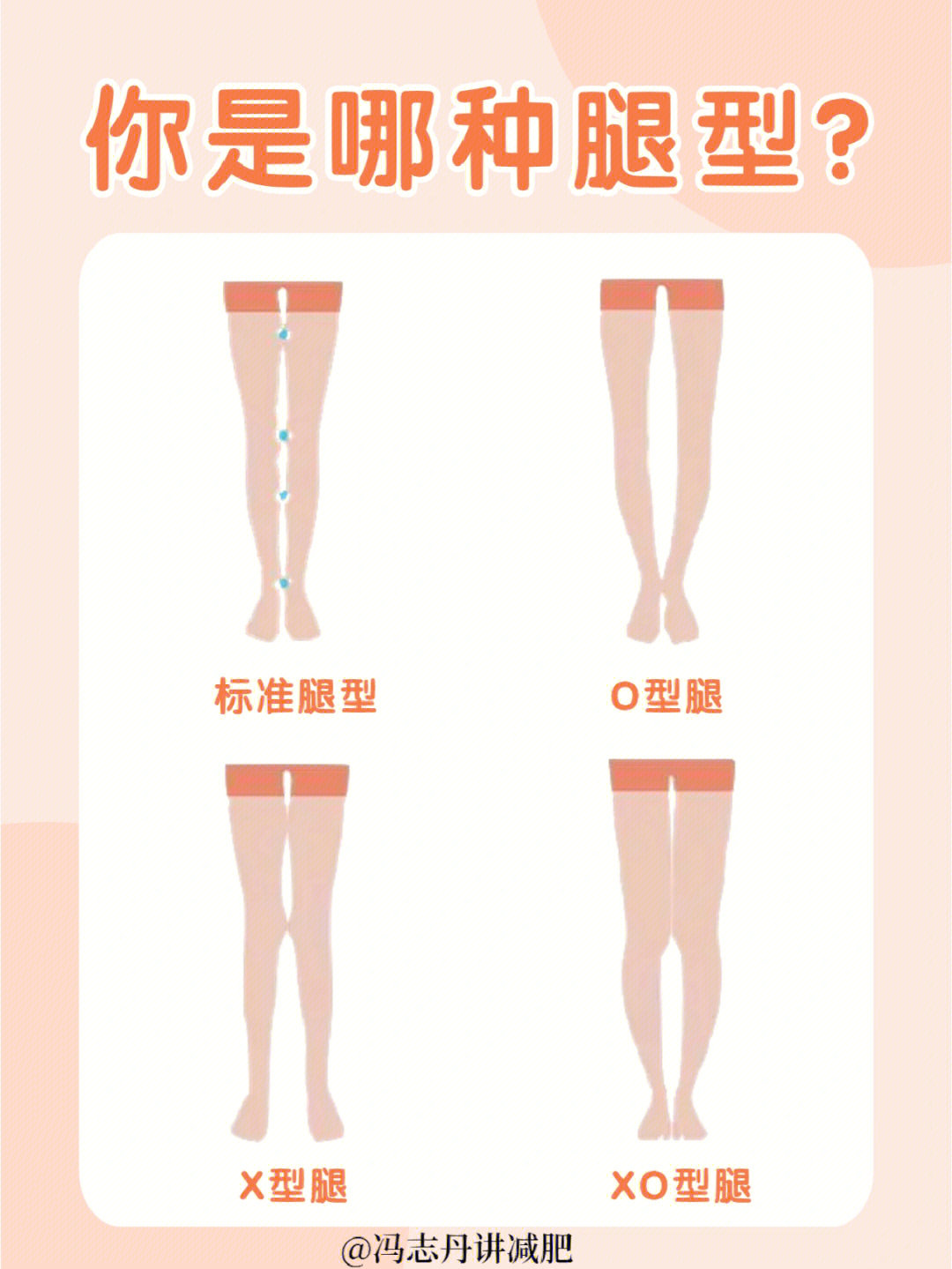 自测你是哪种腿型腿不直如何纠正