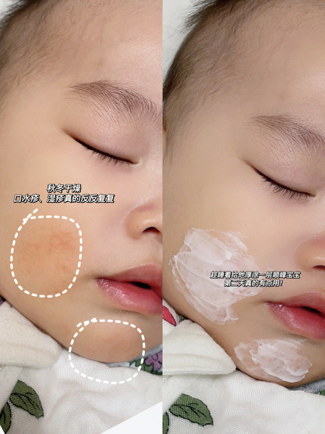 要让皮肤保持湿润,面霜洗完脸就要涂,尤其爱流口水的宝宝