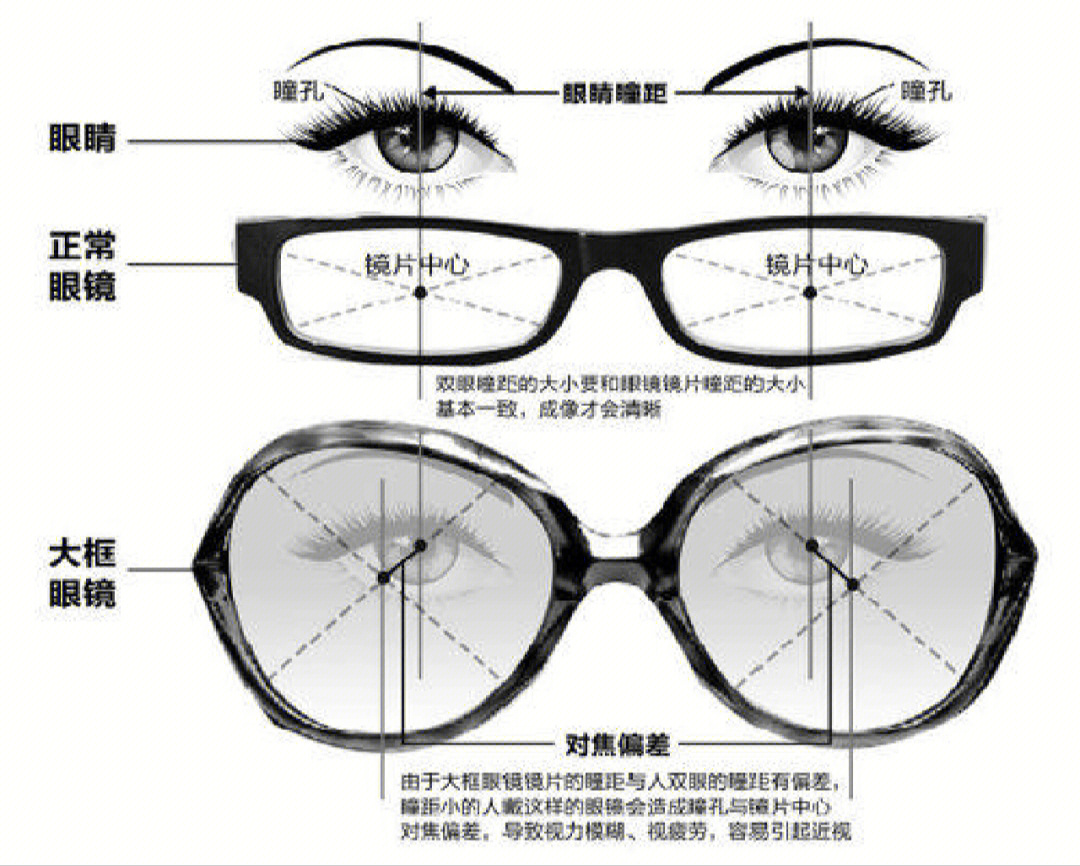 首先说在前面,基本上眼镜店都不会给做普通镜片的顾客测瞳高,常规的